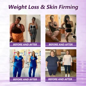 𝐀𝐌𝐙𝐊𝐄𝐄𝐏® 𝐁𝐞𝐫𝐛𝐞𝐫𝐢𝐧𝐞 × 𝐌𝐨𝐫𝐢𝐧𝐠𝐚 𝐒𝐥𝐢𝐦 & 𝐇𝐞𝐚𝐥𝐭𝐡𝐲 𝐍𝐚𝐧𝐨 𝐌𝐢𝐜𝐫𝐨𝐧𝐞𝐞𝐝𝐥𝐞 𝐏𝐚𝐭𝐜𝐡