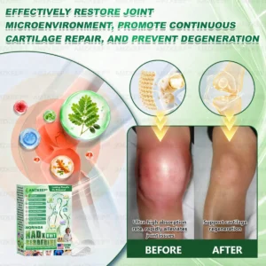 𝐎𝐟𝐟𝐢𝐜𝐢𝐚𝐥 𝐒𝐭𝐨𝐫𝐞 🇺🇸 |𝙰𝙼𝚉𝙺𝙴𝙴𝙿® 𝗠𝗼𝗿𝗶𝗻𝗴𝗮·𝗕𝗲𝗿𝗯𝗲𝗿𝗶𝗻𝗲 × 𝗡𝗔𝗗+ 8-𝗶𝗻-𝟭 𝗡𝗮𝗻𝗼 𝗠𝗶𝗰𝗿𝗼𝗻𝗲𝗲𝗱𝗹𝗲 𝗣𝗮𝘁𝗰𝗵 – 𝗗𝗮𝗶𝗹𝘆, 𝗩𝗶𝘀𝗶𝗯𝗹𝗲 𝗥𝗲𝘀𝘂𝗹𝘁𝘀 𝗶𝗻 𝟳 𝗗𝗮𝘆𝘀 ✅ 𝗙𝗼𝗿 𝗪𝗲𝗶𝗴𝗵𝘁, 𝗦𝗸𝗶𝗻, 𝗗𝗶𝗮𝗯𝗲𝘁𝗲𝘀 & 𝗝𝗼𝗶𝗻𝘁 𝗛𝗲𝗮𝗹𝘁𝗵 🗽