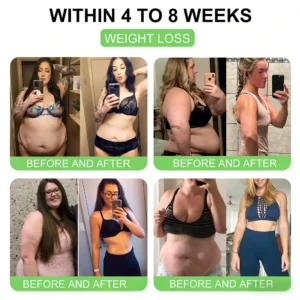 👨‍⚕️𝑨𝑴𝒁𝑲𝑬𝑬𝑷® 𝑵𝑨𝑫+ 𝑴𝒐𝒓𝒊𝒏𝒈𝒂 𝑩𝒆𝒓𝒃𝒆𝒓𝒊𝒏𝒆 𝑨𝑴𝑷𝑲 𝑺𝒖𝒑𝒑𝒐𝒓𝒕 𝑵𝒂𝒏𝒐 𝑴𝒊𝒄𝒓𝒐𝒏𝒆𝒆𝒅𝒍𝒆 𝑷𝒂𝒕𝒄𝒉 (𝐉𝐮𝐬𝐭 𝐨𝐧𝐜𝐞 𝐚 𝐝𝐚𝐲, 𝐯𝐢𝐬𝐢𝐛𝐥𝐞 𝐜𝐡𝐚𝐧𝐠𝐞𝐬 𝐢𝐧 𝟕 𝐝𝐚𝐲𝐬）𝙁𝙤𝙧𝙢𝙪𝙡𝙖 ✅ 𝐅𝐨𝐫 𝑺𝒖𝒑𝒑𝒐𝒓𝒕𝒔 𝑴𝒆𝒕𝒂𝒃𝒐𝒍𝒊𝒔𝒎, 𝑾𝒆𝒊𝒈𝒉𝒕 𝑴𝒂𝒏𝒂𝒈𝒆𝒎𝒆𝒏𝒕, 𝑯𝒆𝒂𝒓𝒕 𝑯𝒆𝒂𝒍𝒕𝒉,𝐨𝐛𝐞𝐬𝐢𝐭𝐲, 𝗟𝗼𝗼𝘀𝗲 𝘀𝗸𝗶𝗻,𝐝𝐢𝐚𝐛𝐞𝐭𝐞𝐬, 𝐬𝐥𝐞𝐞𝐩 𝐚𝐩𝐧𝐞𝐚, 𝐣𝐨𝐢𝐧𝐭 𝐢𝐬𝐬𝐮𝐞𝐬, 𝐚𝐧𝐝 𝐦𝐨𝐫𝐞