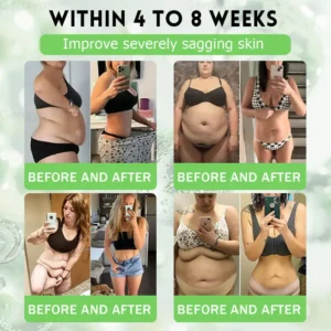 👨‍⚕️𝑨𝑴𝒁𝑲𝑬𝑬𝑷® 𝑵𝑨𝑫+ 𝑴𝒐𝒓𝒊𝒏𝒈𝒂 𝑩𝒆𝒓𝒃𝒆𝒓𝒊𝒏𝒆 𝑨𝑴𝑷𝑲 𝑺𝒖𝒑𝒑𝒐𝒓𝒕 𝑵𝒂𝒏𝒐 𝑴𝒊𝒄𝒓𝒐𝒏𝒆𝒆𝒅𝒍𝒆 𝑷𝒂𝒕𝒄𝒉 (𝐉𝐮𝐬𝐭 𝐨𝐧𝐜𝐞 𝐚 𝐝𝐚𝐲, 𝐯𝐢𝐬𝐢𝐛𝐥𝐞 𝐜𝐡𝐚𝐧𝐠𝐞𝐬 𝐢𝐧 𝟕 𝐝𝐚𝐲𝐬）𝙁𝙤𝙧𝙢𝙪𝙡𝙖 ✅ 𝐅𝐨𝐫 𝑺𝒖𝒑𝒑𝒐𝒓𝒕𝒔 𝑴𝒆𝒕𝒂𝒃𝒐𝒍𝒊𝒔𝒎, 𝑾𝒆𝒊𝒈𝒉𝒕 𝑴𝒂𝒏𝒂𝒈𝒆𝒎𝒆𝒏𝒕, 𝑯𝒆𝒂𝒓𝒕 𝑯𝒆𝒂𝒍𝒕𝒉,𝐨𝐛𝐞𝐬𝐢𝐭𝐲, 𝗟𝗼𝗼𝘀𝗲 𝘀𝗸𝗶𝗻,𝐝𝐢𝐚𝐛𝐞𝐭𝐞𝐬, 𝐬𝐥𝐞𝐞𝐩 𝐚𝐩𝐧𝐞𝐚, 𝐣𝐨𝐢𝐧𝐭 𝐢𝐬𝐬𝐮𝐞𝐬, 𝐚𝐧𝐝 𝐦𝐨𝐫𝐞